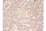 Immunohistochemical of paraffin-embedded human liver tissue using CSB-MA114091A0m at dilution of 1:200
