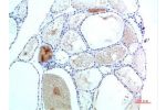 Immunohistochemical analysis of paraffin-embedded Human Thyroid Tissue using TTR Mouse mAb diluted at 1:200.