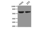 Western Blot<br />
Positive WB detected in:Hela whole cell lysate,HEK293 whole cell lysate<br />
All lanes : PODXL antibody at 2.5 ug/ml<br />
Secondary<br />
Goat polyclonal to Mouse IgG at 1/5000 dilution<br />
Predicted band size: 59, 56 kDa<br />
Obse
