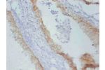 Immunohistochemistry of paraffin-embedded Rat prostate cancer using CSB-MA167191A0m at dilution of 1:100.
