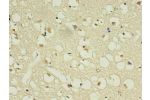 Immunohistochemistry of paraffin-embedded human brain using CSB-MA168601A0m in 30ug/ml dilute concentrations.
