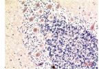Immunohistochemical analysis of paraffin-embedded Human Brain Tissue using LC3B Mouse mAb diluted at 1:200.