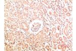 Immunohistochemical analysis of paraffin-embedded Human Kidney Tissue using Collagen IV  Mouse mAb diluted at 1:200.