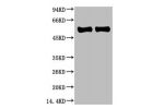 Western blot analysis of Arabidopsis with Rubisco(Large Chain) Mouse mAb diluted at 1)1:2,000;2)1:5,000