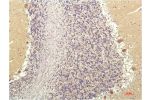 Immunohistochemical analysis of paraffin-embedded Human Brain Tissue using SGK1 Mouse mAb diluted at 1:200.