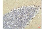Immunohistochemical analysis of paraffin-embedded Human Brain Tissue using PPAR Delta Mouse mAb diluted at 1:200.