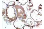 Immunohistochemical analysis of paraffin-embedded Human Thyroid Tissue using TTR Mouse mAb diluted at 1:200.