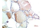 Immunohistochemical analysis of paraffin-embedded Human Thyroid Tissue using TTR Mouse mAb diluted at 1:200.