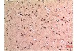 Immunohistochemical analysis of paraffin-embedded Human Brain Tissue using Beclin-1 Mouse mAb diluted at 1:200.