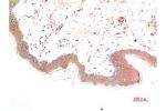 Immunohistochemical analysis of paraffin-embedded Human Skin Tissue using Phospho-Smad3(S425) Mouse mAb diluted at 1:200.