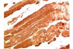Immunohistochemical analysis of paraffin-embedded Human Skeletal Muscle Tissue using NBR1  Mouse mAb diluted at 1:200.