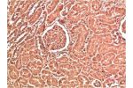 Immunohistochemical analysis of paraffin-embedded Human Kidney Tissue using Collagen IV  Mouse mAb diluted at 1:200.
