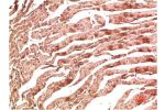 Immunohistochemical analysis of paraffin-embedded Rat Heart Tissue using VE-Cadherin  Mouse mAb diluted at 1:200.