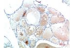 Immunohistochemical analysis of paraffin-embedded Human Thyroid Tissue using TTR Mouse mAb diluted at 1:200.