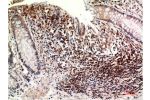 Immunohistochemical analysis of paraffin-embedded Human Colon Carcinoma Tissue using Epsilon Tubulin Mouse mAb diluted at 1:200.