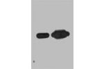 Western blot analysis of Recombinant Nano-Tag9 Protein with Nano-Tag9 Mouse mAb diluted at 1)1:10,000;2)1:5,000