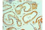 Immunohistochemical of paraffin-embedded Human testis tissue using CSB-MA8587101A0m at dilution of 1:200.