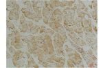Immunohistochemical analysis of paraffin-embedded Mouse Skeletal Muscle Tissue using Desmin(mAb diluted at 1:200.