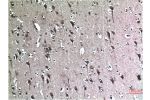 Immunohistochemical analysis of paraffin-embedded Human Brain Tissue using Beclin-1 Mouse mAb diluted at 1:200.