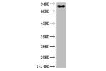 Western blot analysis of Firefly Luciferase Transfected Hela Cell Lysate using Luciferase Mouse mAb diluted at 1:2000.