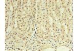 Immunohistochemistry of paraffin-embedded human adrenal gland using CSB-MA999881A0m in 30ug/ml dilute concentrations.