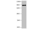 All lanes: Mouse Anti-BSA monoclonal antibody at 1ug/ml<br />
Lane 1:Bovine serum Albumin<br />
Predicted band size : 67kd<br />
Observed band size : 67kd<br />