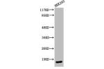 Western Blot analysis of 293 cells using Cleaved-Caspase-3 p17 (D175) Polyclonal Antibody