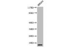 Western Blot analysis of 293 cells using Cleaved-Caspase-7 (S199) Polyclonal Antibody