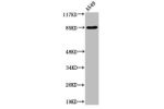 Western Blot analysis of A549 cells using ADAM10 Polyclonal Antibody