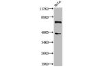 Western Blot analysis of HeLa cells using Cleaved-C1s HC (R437) Polyclonal Antibody