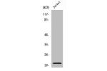 Western Blot analysis of Jurkat cells using Cleaved-Caspase-7 p20 (D198) Polyclonal Antibody