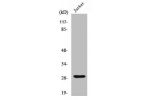 Western Blot analysis of Jurkat cells using Cleaved-Cathepsin C HC (R394) Polyclonal Antibody