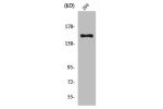 Western Blot analysis of 293 cells using Cleaved-COL4A3 (L1425) Polyclonal Antibody