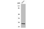 Western Blot analysis of Jurkat cells using Cleaved-KLK8 (V33) Polyclonal Antibody