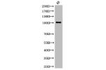 Western Blot analysis of KB cells using Cleaved-Notch 1 (V1754) Polyclonal Antibody