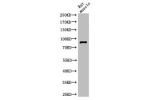 Western Blot analysis of rat-musle cells using Cleaved-PARP-1 (G215) Polyclonal Antibody