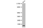 Western Blot analysis of HeLa cells using Cleaved-SUMO-2/3 (G93) Polyclonal Antibody