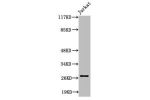 Western Blot analysis of Jurkat cells using Cleaved-Tumstatin (P1426) Polyclonal Antibody