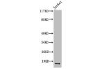 Western Blot analysis of Jurkat cells using Cleaved-Factor VII LC (R212) Polyclonal Antibody