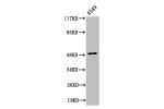 Western Blot analysis of A549 cells using Cleaved-Factor X/ Factor X LC (A41) Polyclonal Antibody