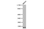 Western Blot analysis of 293 cells using Cleaved-Integrin a5 LC (E895) Polyclonal Antibody