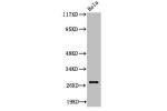 Western Blot analysis of HeLa cells using Cleaved-Integrin a6 LC (E942) Polyclonal Antibody