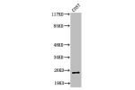 Western Blot analysis of COS7 cells using Cleaved-Integrin a7 LC (E959) Polyclonal Antibody