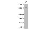 Western Blot analysis of A549 cells using Cleaved-Integrin aV HC (K889) Polyclonal Antibody