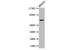 Western Blot analysis of 293 cells using Cleaved-ITI-H2 (D702) Polyclonal Antibody