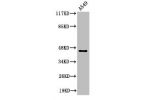 Western Blot analysis of A549 cells using Cleaved-MASP-1 HC (R448) Polyclonal Antibody