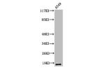 Western Blot analysis of A549 cells using Cleaved-MMP-1 22k (F100) Polyclonal Antibody
