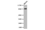 Western Blot analysis of 293 cells using Cleaved-MPO 89k (A49) Polyclonal Antibody