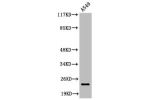 Western Blot analysis of A549 cells using Cleaved-PARP-1 (D214) Polyclonal Antibody