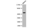 Western Blot analysis of 293 cells using Cleaved-Plasminogen HC A short form (V98) Polyclonal Antibody